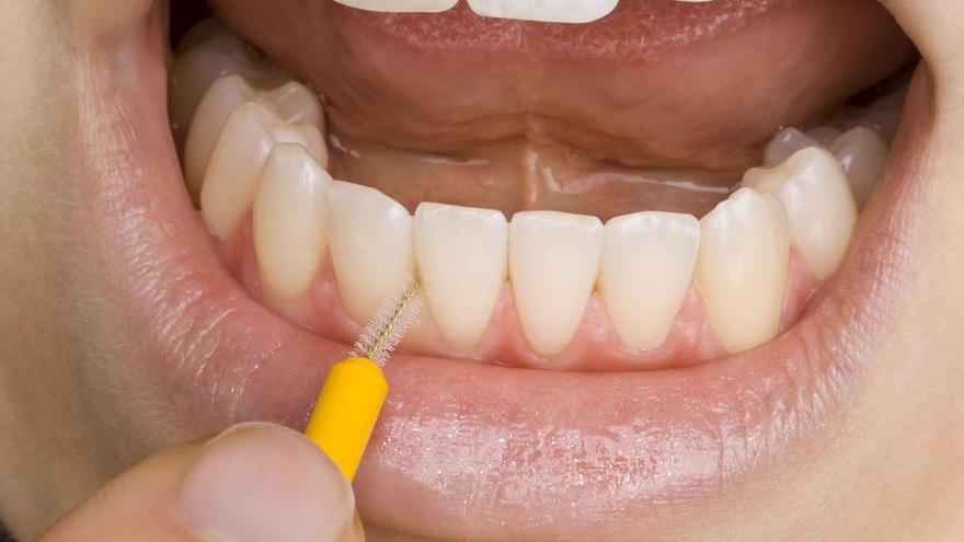 El cepillo interdental es clave para una buena higiene bucal