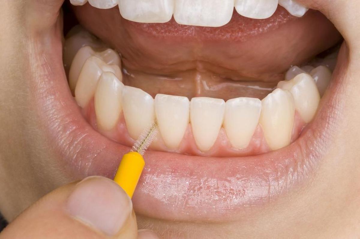 El cepillo interdental es clave para una buena higiene bucal