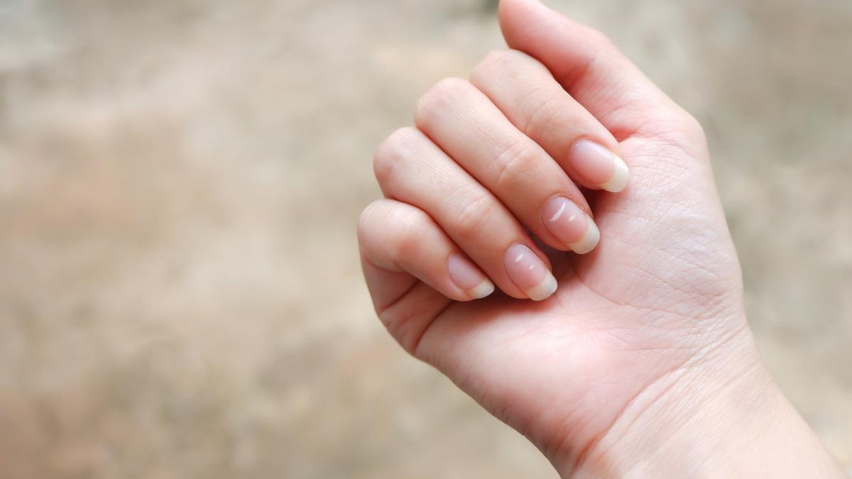 Enfermedades que se reflejan en las uñas