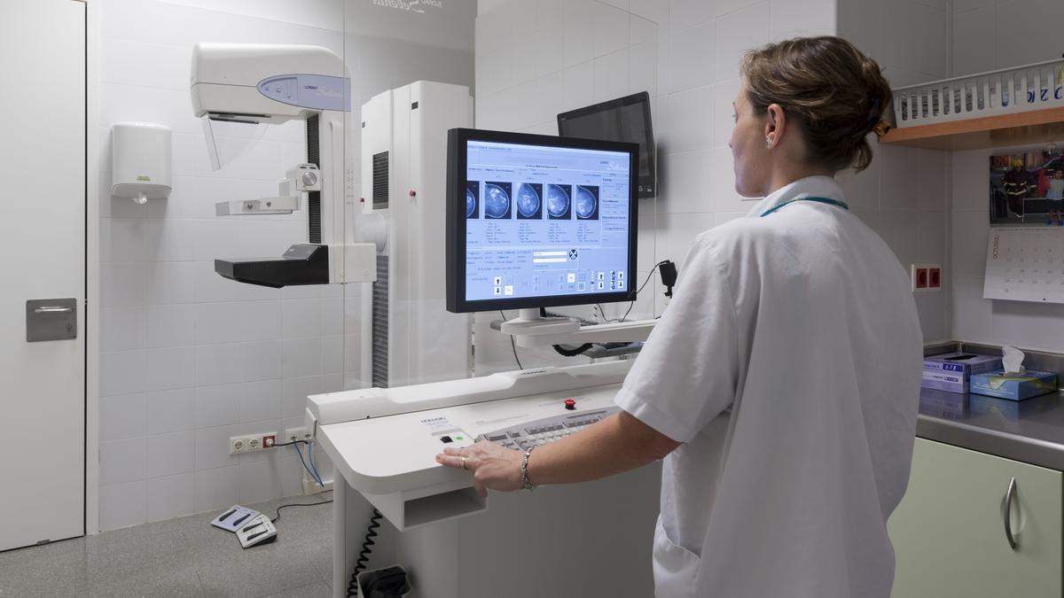Al monitor, la imatge d&#039;una mamografia feta a l&#039;Hospital d&#039;Igualada