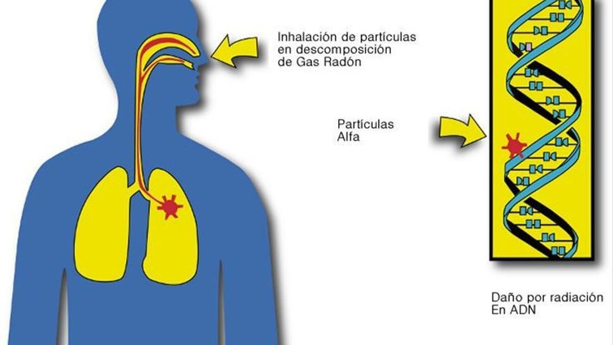 Inhalación de gas radón