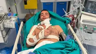 Petrucci se rompe la clavícula y la mandíbula entrenando motocross