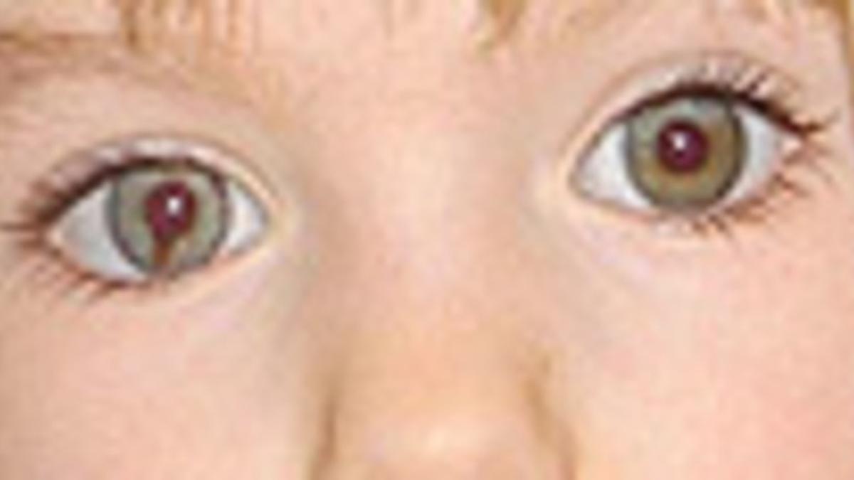 Madeleine McCann.