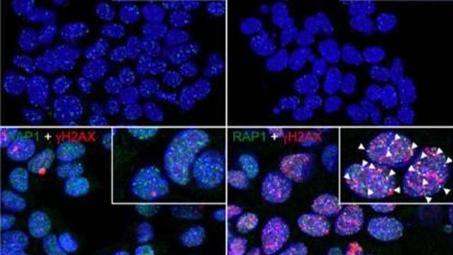 El equipo de María Blasco logra destruir las células cancerígenas