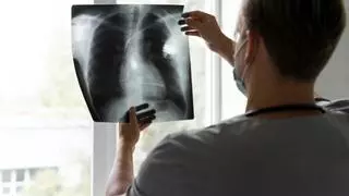 No hay pulmones que no se beneficien: así es la subespecialidad desconocida que trata cualquier enfermedad respiratoria