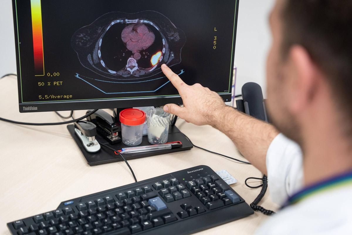 Un médico muestra la tomografía de un paciente de cáncer de Pleura. Foto archivo