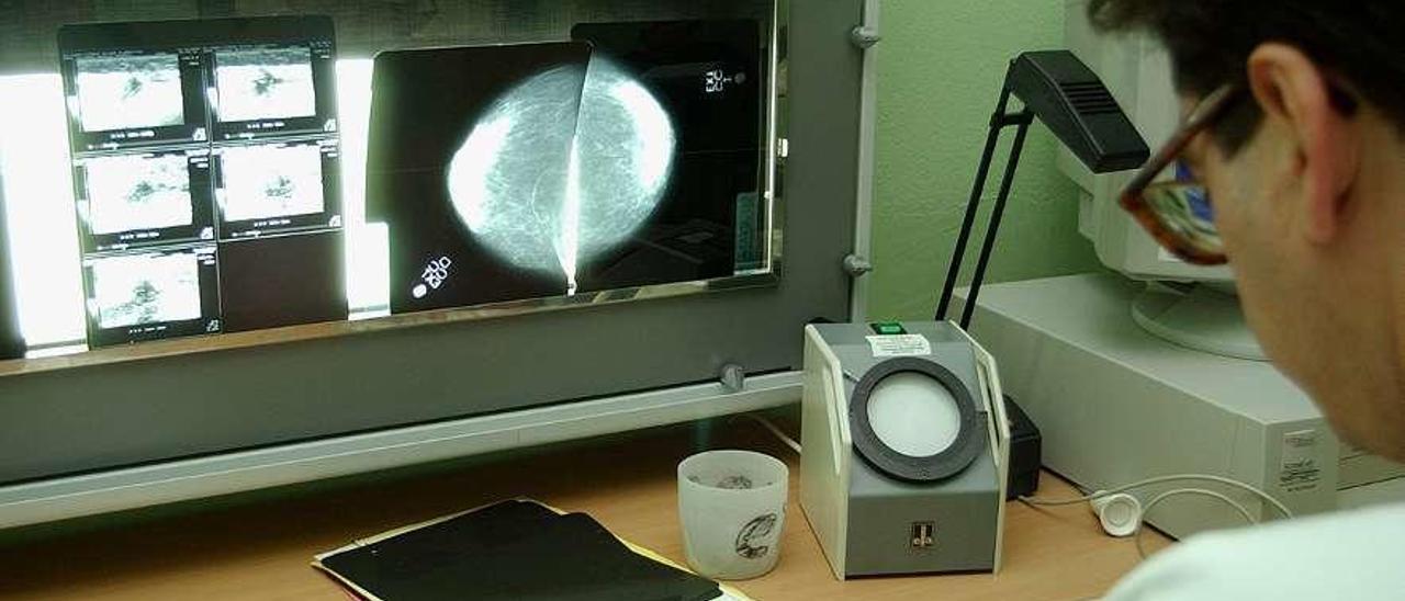 Resultados de una mamografía.