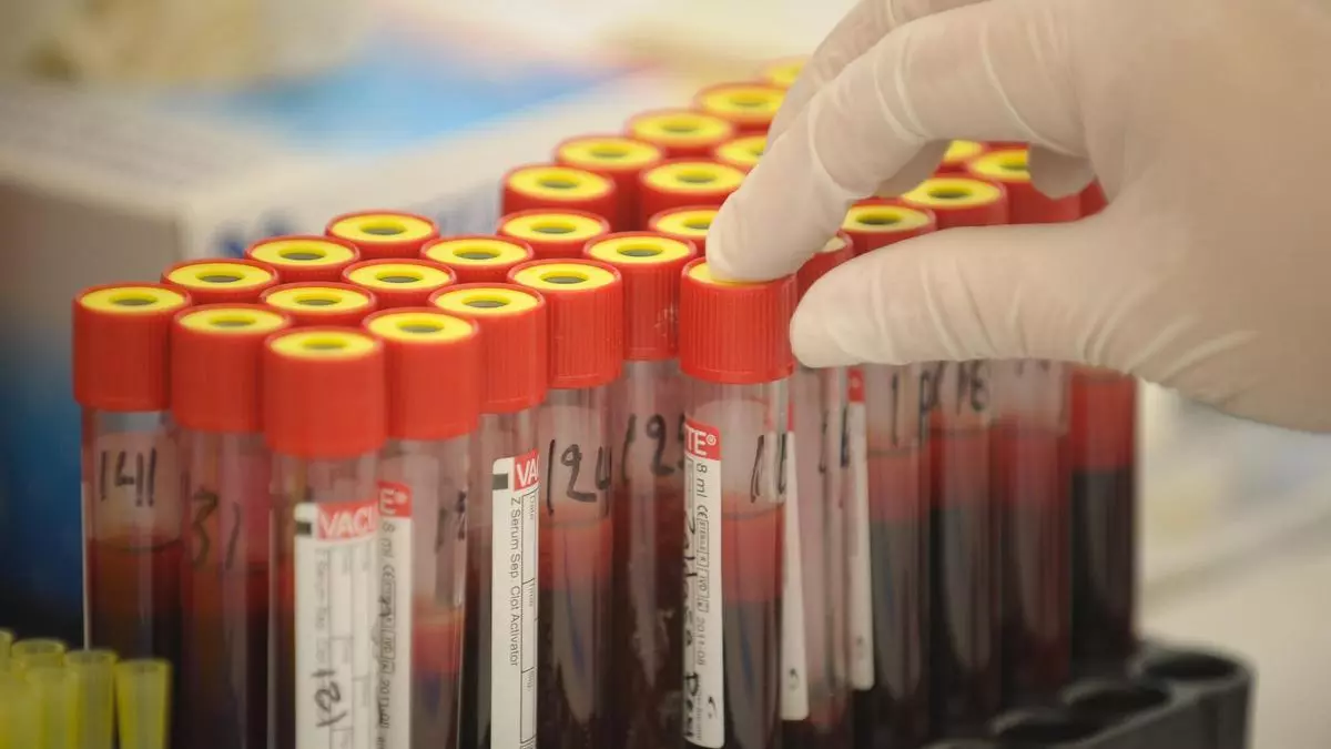 Lanzan el fármaco lenacapavir en Kenia de forma gratuita para prevenir contagios por VIH