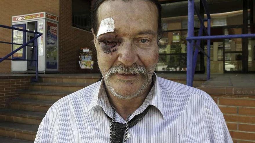 Francisco Gutiérrez, en la estación de autobúses de Benavente, tras ser atendido en el Hospital