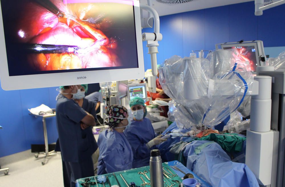 El robot Da Vinci en la primera cirugía en el Hospital General