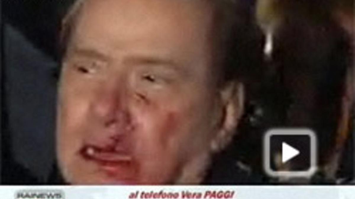 Berlusconi, con el rostro ensangrentado.