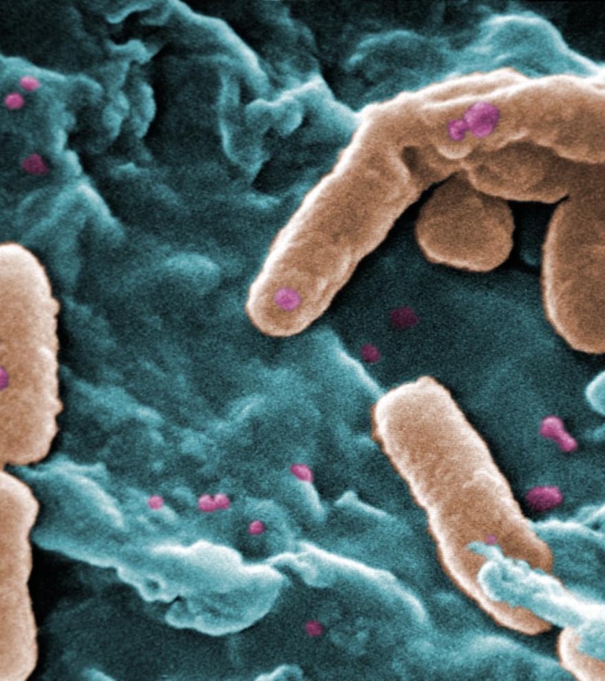 Disminuye la resistencia a los antibióticos de una de las bacterias más mortales, pero aumenta la amenaza de ST235