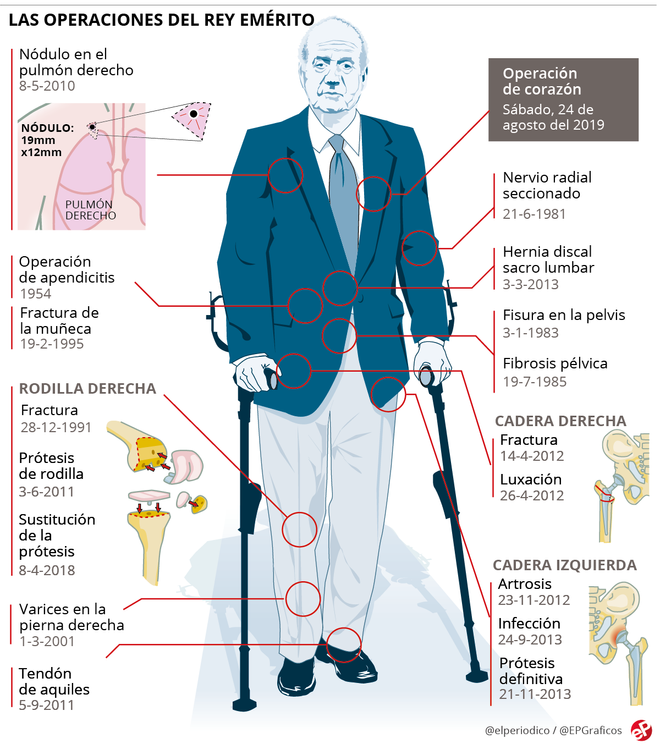 operaciones rey