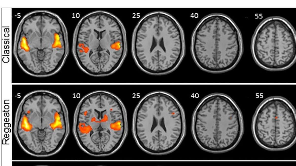 El reguetón provoca mayor actividad cerebral que escuchar clásica o folclore