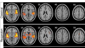 El reguetón provoca mayor actividad cerebral que escuchar clásica o folclore