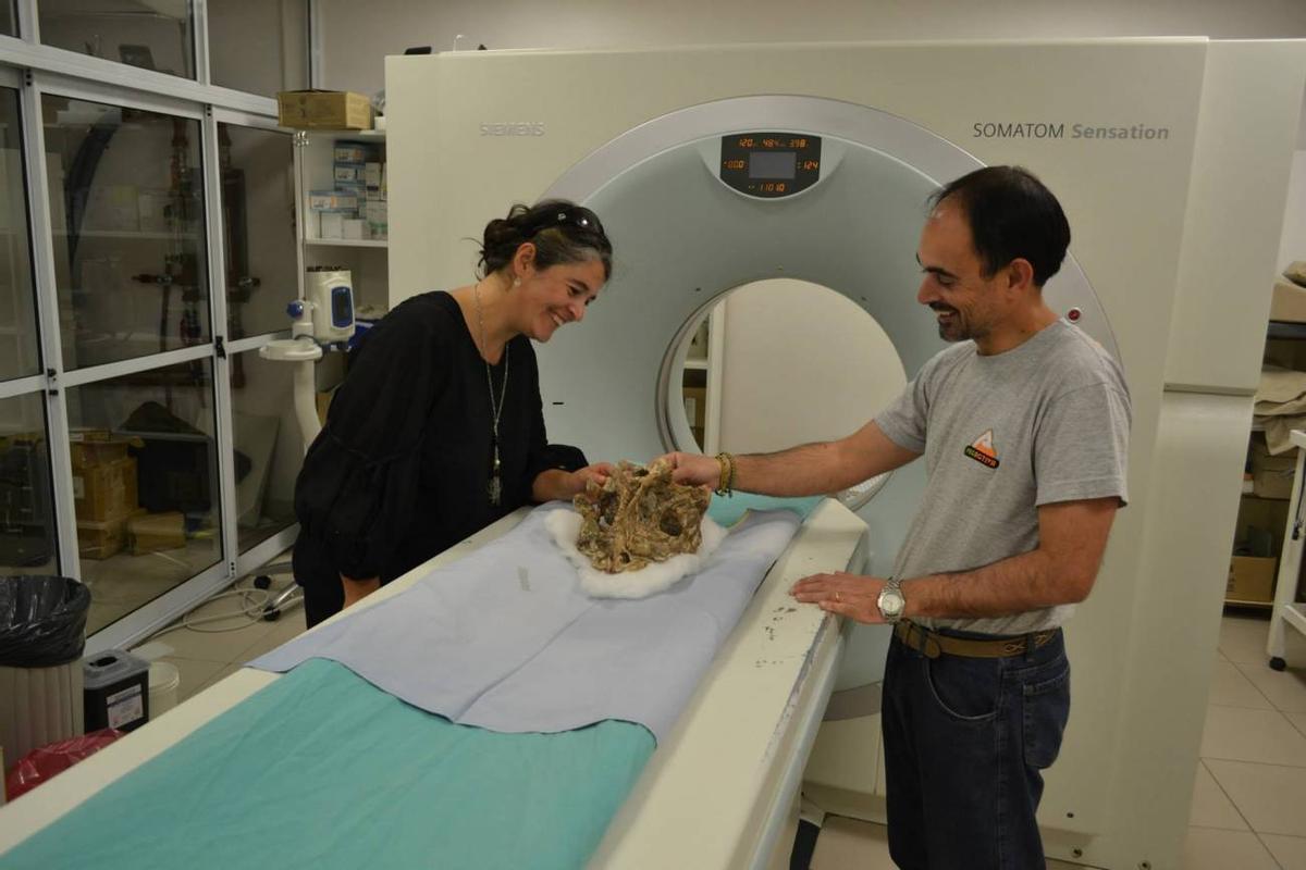 Las tomografías computadas por rayos X permiten extraer información sobre la forma del cerebro