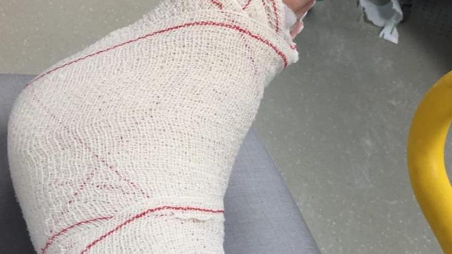 Una fotografía del tobillo derecho de Manuela Carmena.