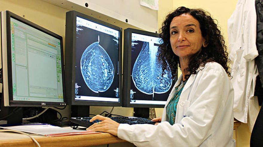 Doctora Marta Manero Jiménez, Responsable del área de Radiología del Hopital HLA Vistahermosa de Alicante