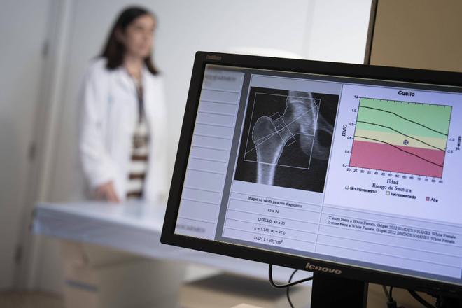 España suspende en osteoporosis: el 72% de mujeres de más 50 años no reciben tratamiento tras una fractura por fragilidad