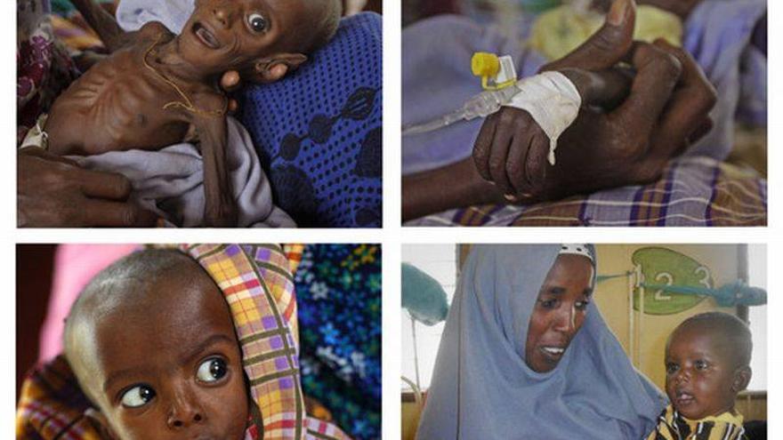 El bebé imagen del hambre en Somalia se recupera