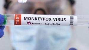 Una sanitaria muestra un test positivo de viruela del mono.