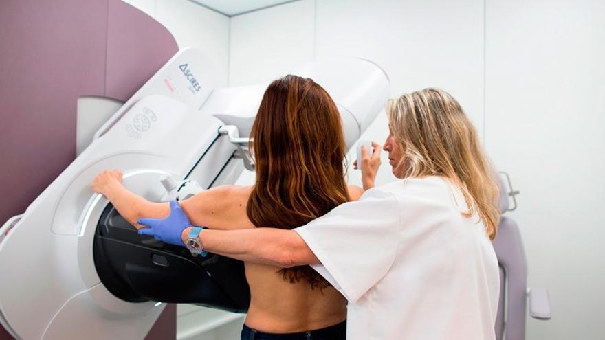 La AECC acaba con la lista de espera para las mamografías del programa de cribado