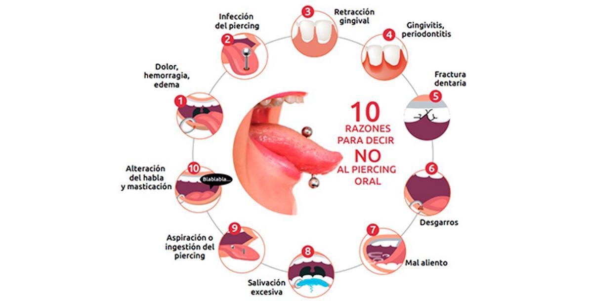 ¿Por qué no son saludables los piercings orales? 10 razones para no llevarlos