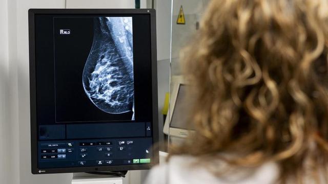 Una mamografía para detercar cáncer de mama