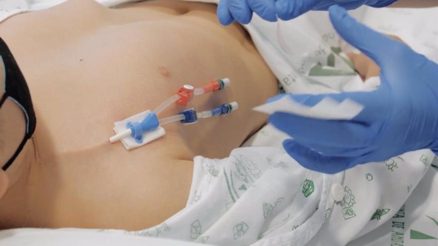 Depender de una máquina para seguir viviendo: así es el día a día de una paciente pediátrica en diálisis