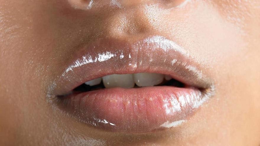 Del &#039;bótox party&#039; a los labios rusos: los médicos alertan de &quot;un nuevo tipo de delincuencia&quot; que comercia con productos estéticos del mercado negro