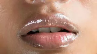 Del 'bótox party' a los labios rusos: los médicos alertan de "un nuevo tipo de delincuencia" que comercia con productos estéticos del mercado negro