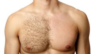 Ventajas y desventajas de la depilación masculina