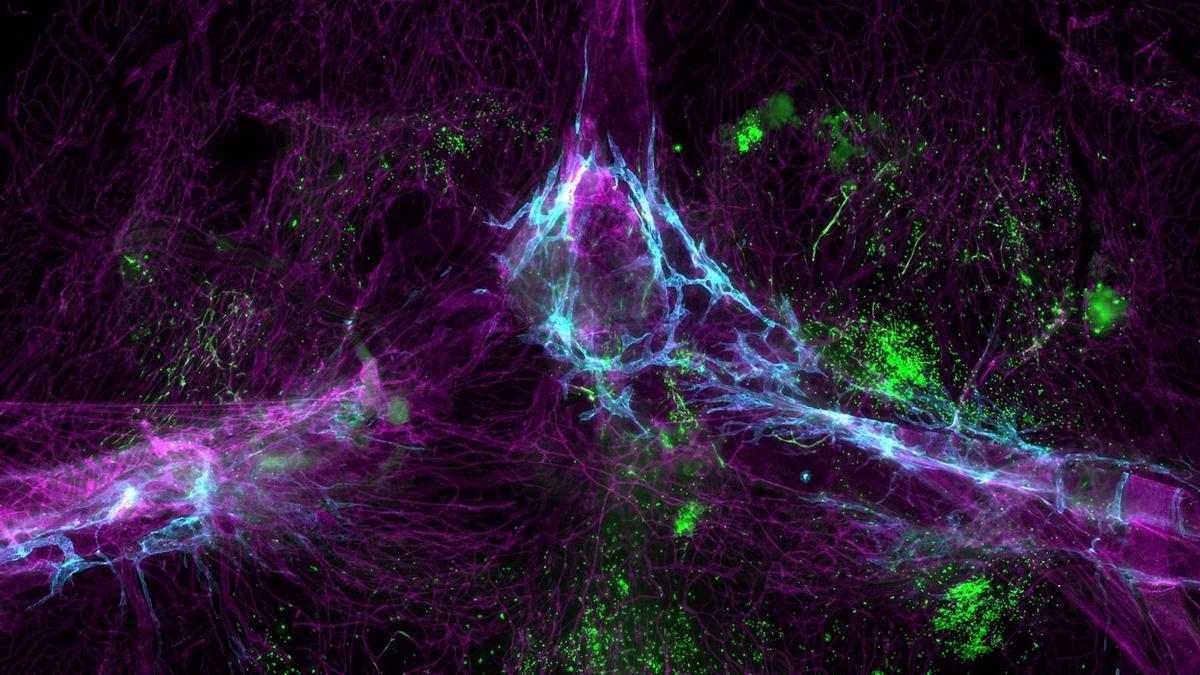 El sistema inmunitario del cerebro incluye una red de vasos de transporte (azul) y sus propias células inmunitarias producidas en la médula ósea (verde).