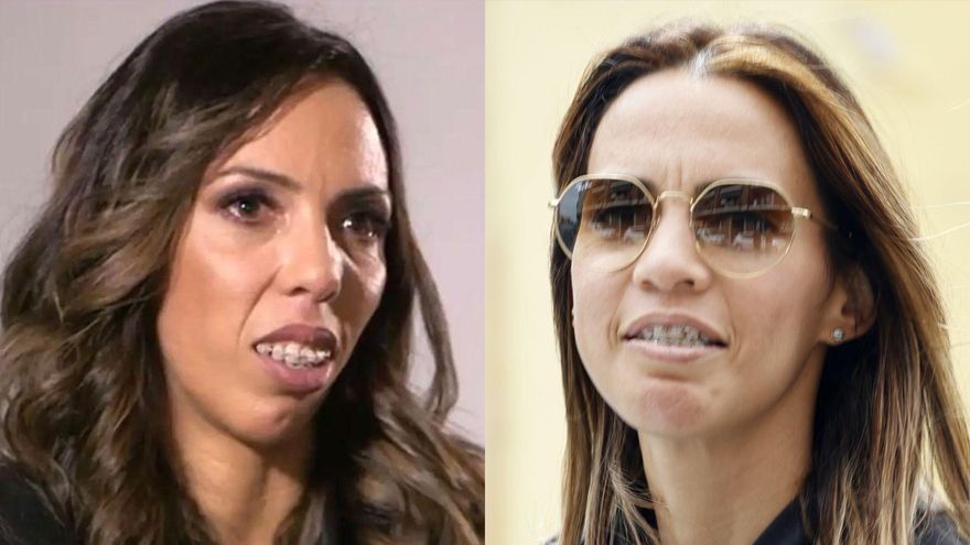 Paola Olmedo muestra por primera vez el enorme cambio en su cara tras su difícil operación estética: el sorprendente antes y el después