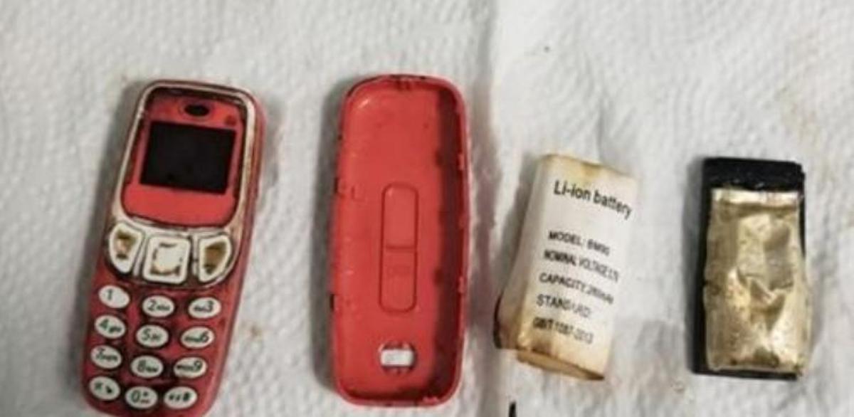 Las tres partes en que fue extraído el móvil del cuerpo del paciente, con la batería ya separada