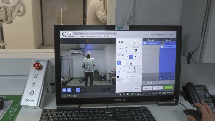 Alicante es el primer punto de España que hace radiografías con una cámara de inteligencia artificial