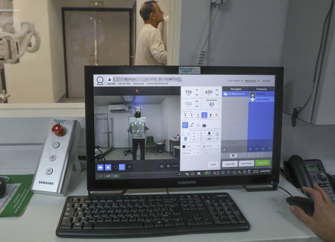 Alicante es el primer punto de España que hace radiografías con una cámara de inteligencia artificial
