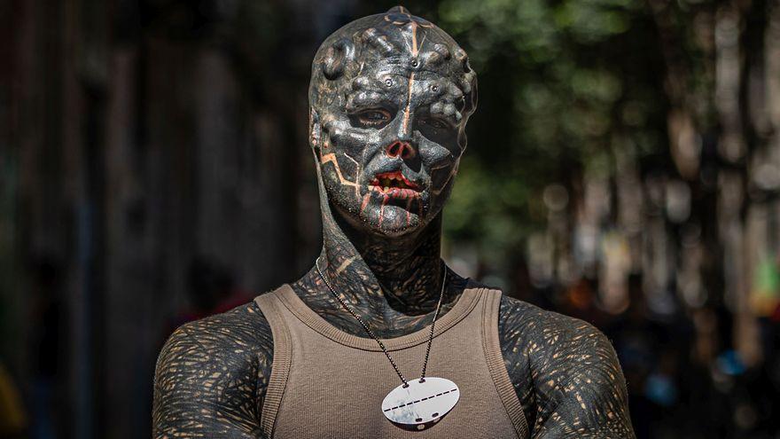 Retrato callejero de Anthony. Se extirpó en julio parte del labio superior.