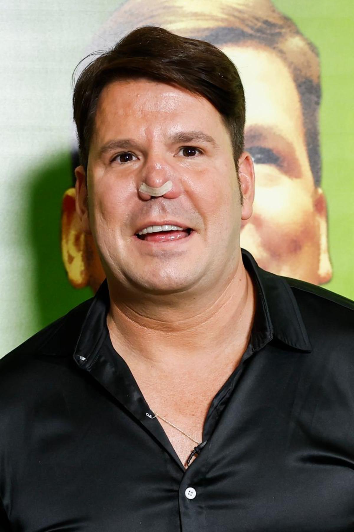 lucas nariz