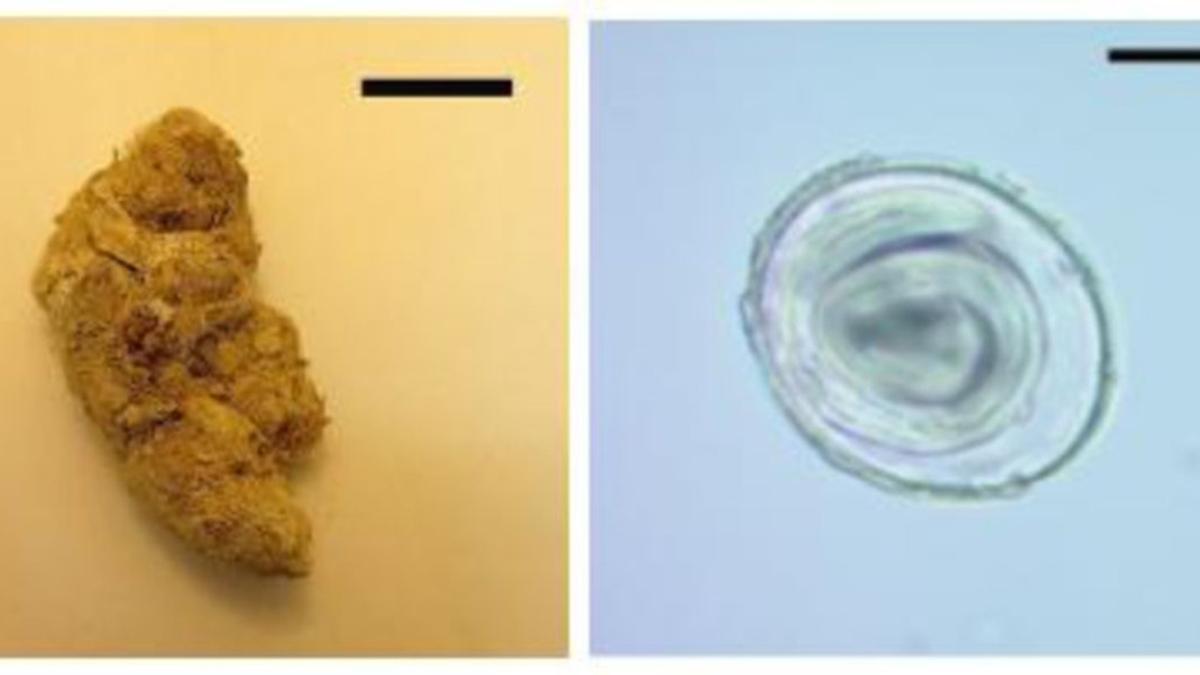 Coprolito donde se ha encontrado la muestra (izquierda) y huevo de la lombriz Toxascaris leonina (derecha)