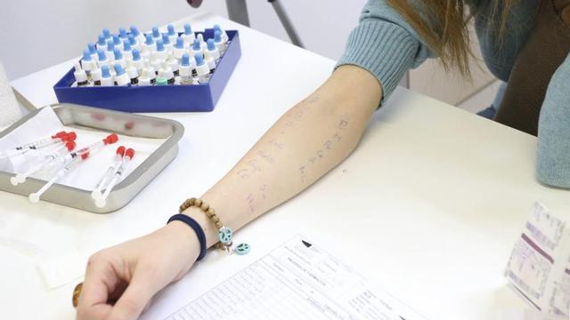 Pruebas a una paciente para conocer qué tipo de alergia padece.