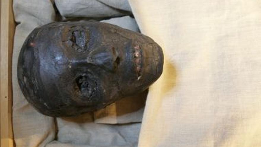 Una enfermedad ósea y la malaria crónica causaron la muerte precoz de Tutankamón