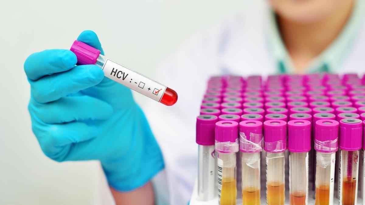 Imagen de archivo de un test de la hepatitis C