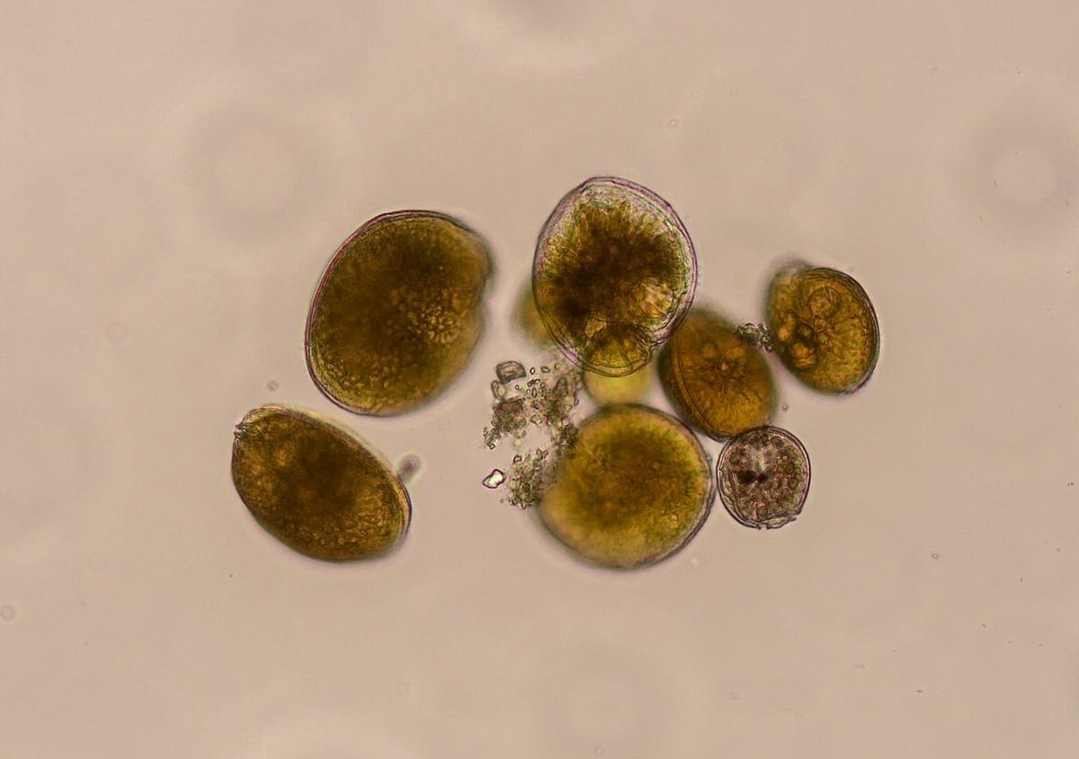 Imagen de 'Gambierdiscus australes' en microscopio óptico invertido.