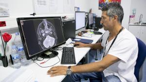 Un neurólogo revisa las pruebas de imagen de un cerebro.