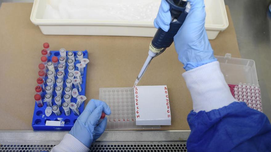 Mallorca deckelt Preise für PCR- und Antigentests