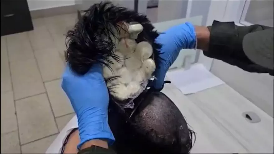 Vídeo | Intercepten a l'aeroport de Colòmbia un home amb un perruquí amb 10.000 euros de droga amagada