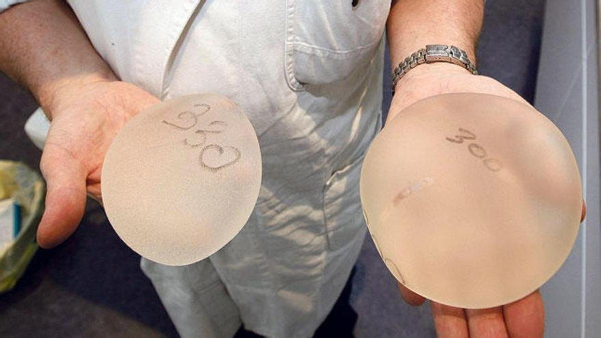 Implantes mamarios defectuosos que fueron retirados del mercado.