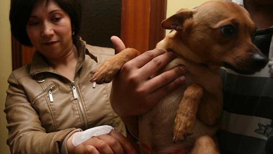 La mujer a la que los perros mordieron en la mano muestra las heridas en el abdomen que le causaron a su chiguagua