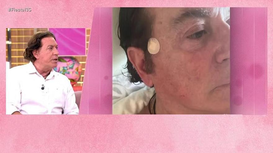 Pipi Estrada, preocupado por su salud tras someterse a una biopsia: "Estoy un poco acojonado"